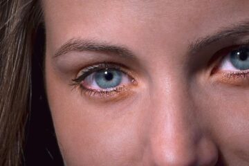 Causas Emocionales del Glaucoma - Blog - Laura Casart