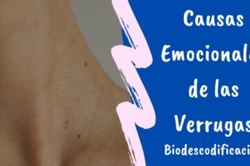 Causas Emocionales de las Verrugas - Blog - Laura Casart