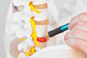 Causas Emocionales de la Hernia Discal - Blog - Laura Casart