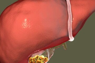 Causas Emocionales que dañan la Vesícula Biliar - Blog - Laura Casart