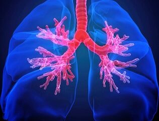 Causas Emocionales de la Bronquitis - Blog - Laura Casart