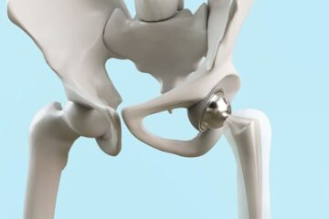 Causas Emocionales del Dolor en la Cadera - Blog - Laura Casart